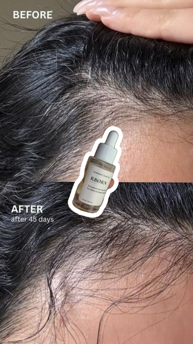 Story: Serum bottle splits before/after scalp