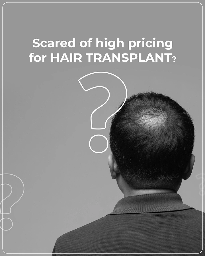 Hair Transplant & Hair Clinics creative ad: Question mark over bald head, pricing fear