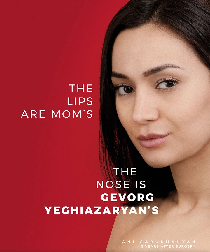 Plastic Surgery Clinics creative ad: Witty ownership copy personalizes procedures