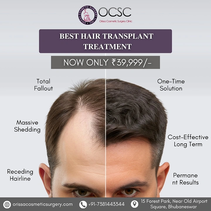 Hair Transplant & Hair Clinics creative ad: Split-head before/after with benefit callouts