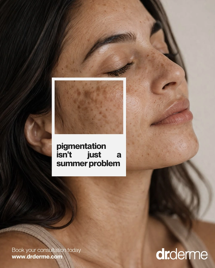 Skin & Cosmetic Clinics creative ad: Polaroid frame zooms on pigmentation