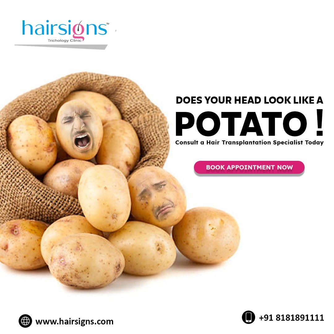 Instagram post: Bald head as potato visual pun