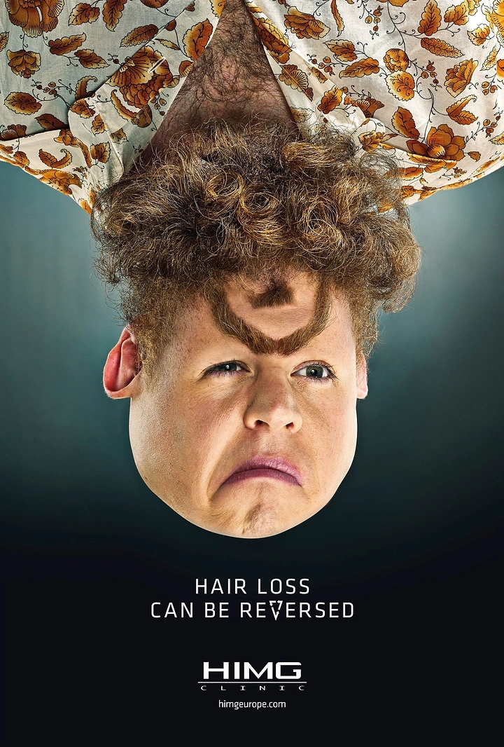 Hair Transplant & Hair Clinics creative ad: Upside-down balding man whose hairy chest reads as a full head of hair
