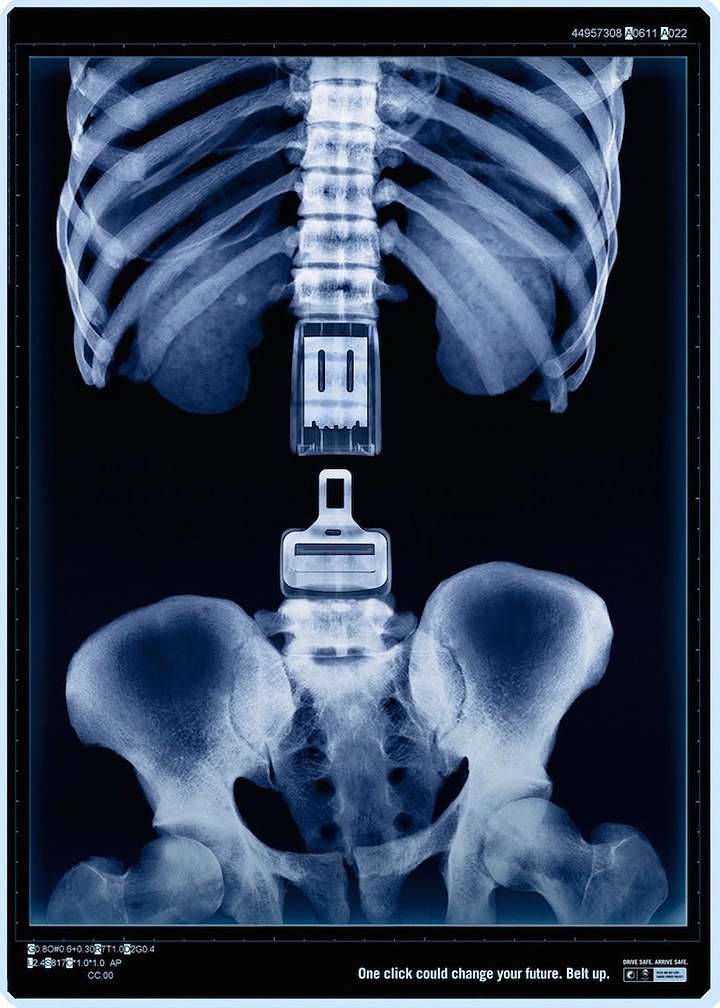 Insurance creative ad: X-ray spine replaced by a seatbelt buckle and tongue