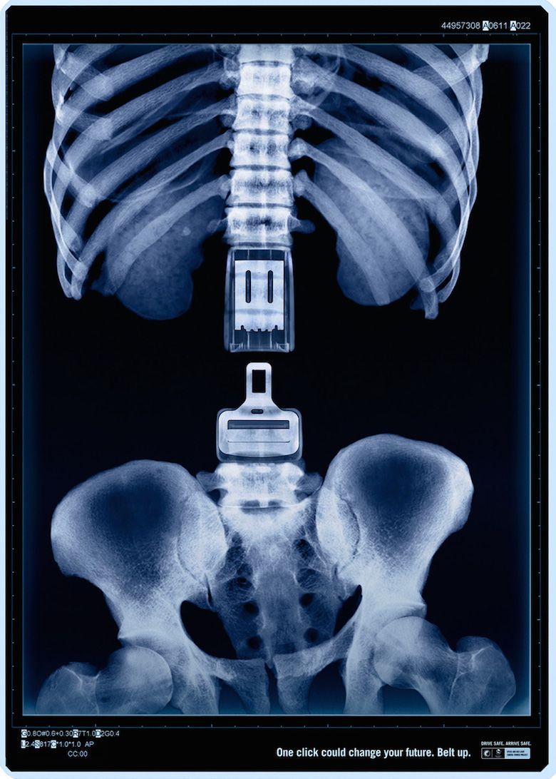 X-ray spine replaced by a seatbelt buckle and tongue