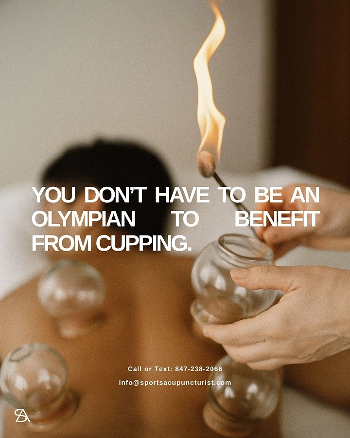 Acupuncture & Cupping Clinics creative ad: Olympian pun sells accessible cupping