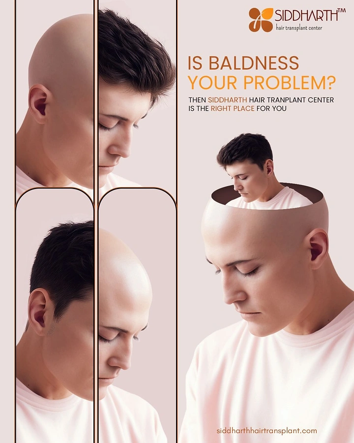 Hair Transplant & Hair Clinics creative ad: Man peeling off bald head reveals hair