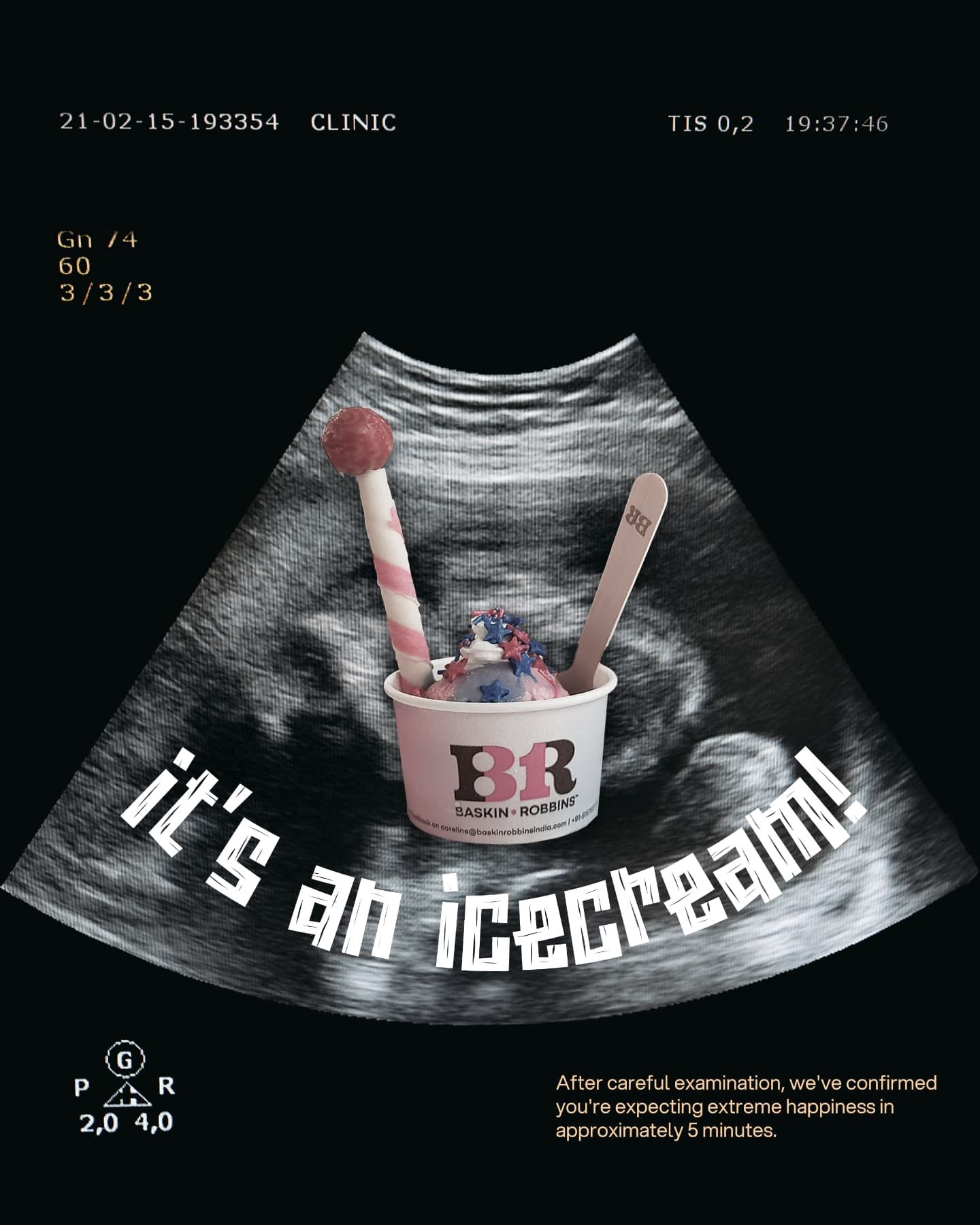 Instagram post: Ice cream cup inside an ultrasound scan
