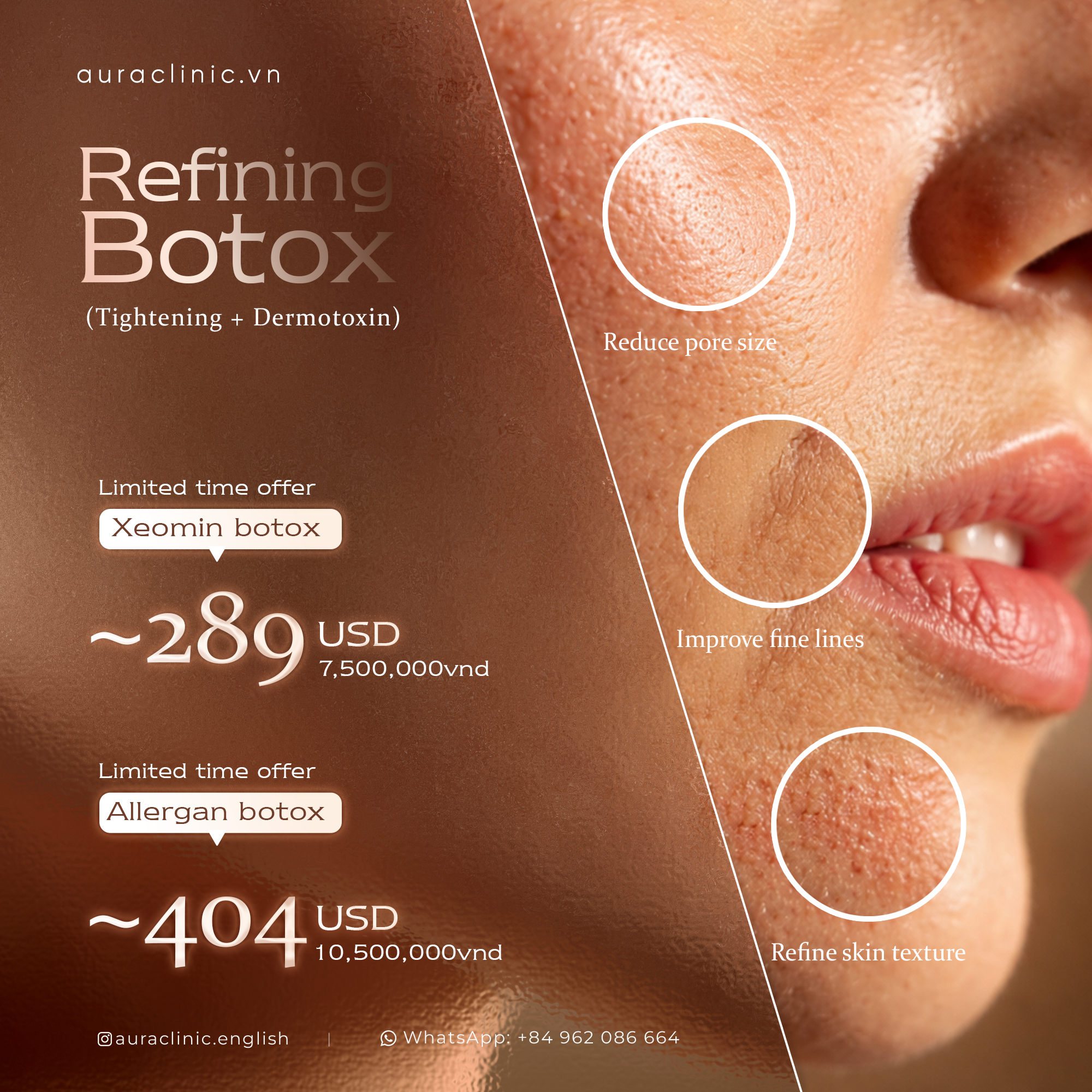 Instagram post: Magnified skin circles show botox benefits