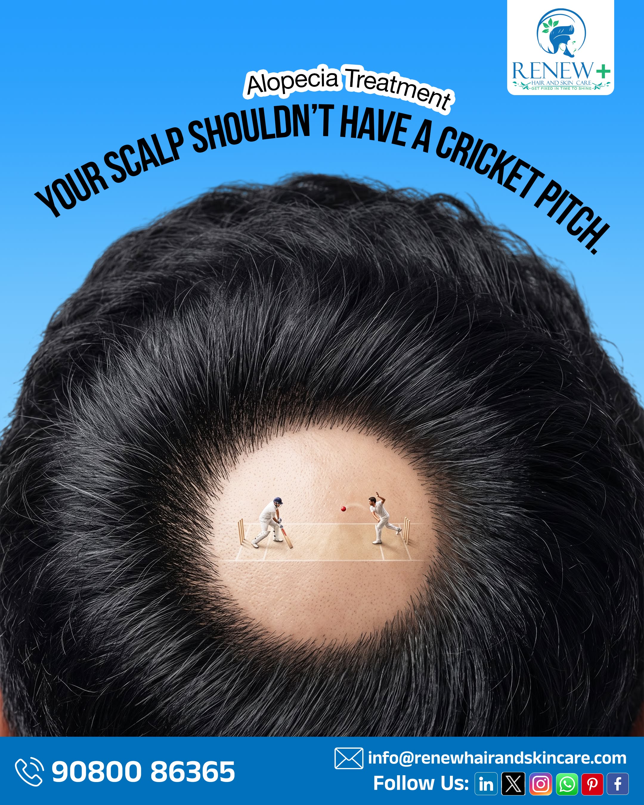 Instagram post: Bald spot as cricket pitch pun