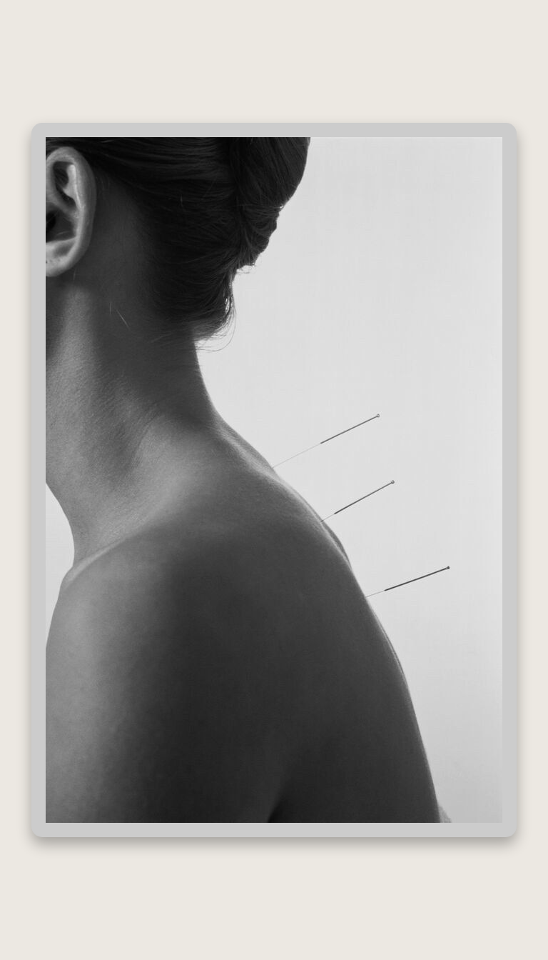 Story: Minimal framed composition turns needles graphic