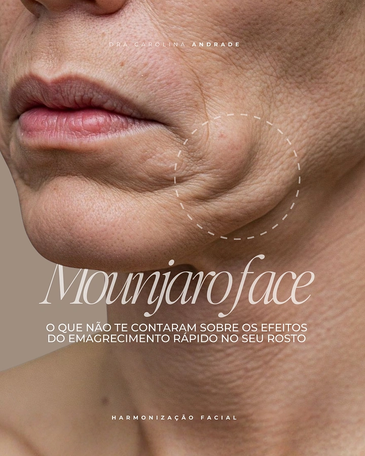 Skin & Cosmetic Clinics creative ad: Circled sagging skin, topical 'Mounjaro face' hook