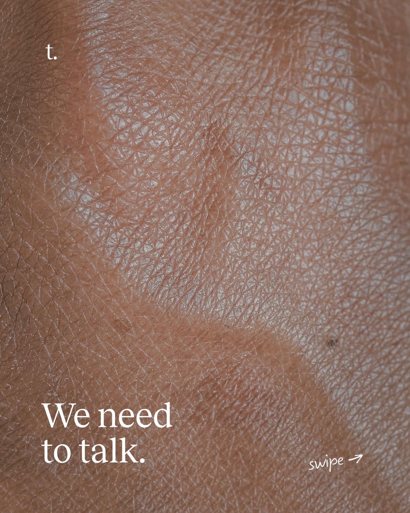 Instagram post: Extreme skin close-up, 'We need to talk', slide 1