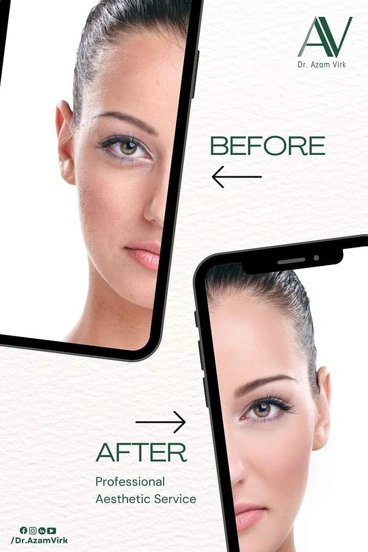 Plastic Surgery Clinics creative ad: Phones create before-after composition