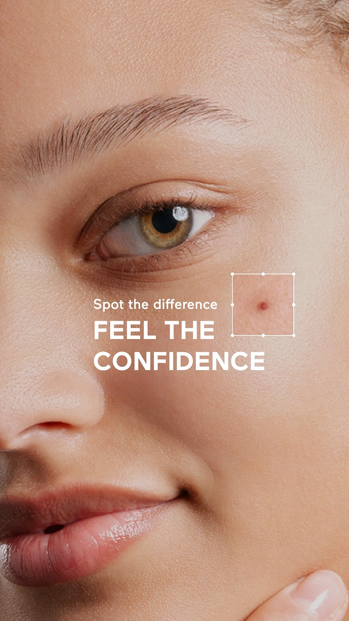 Skin & Cosmetic Clinics creative ad: Spot the difference framing on blemish