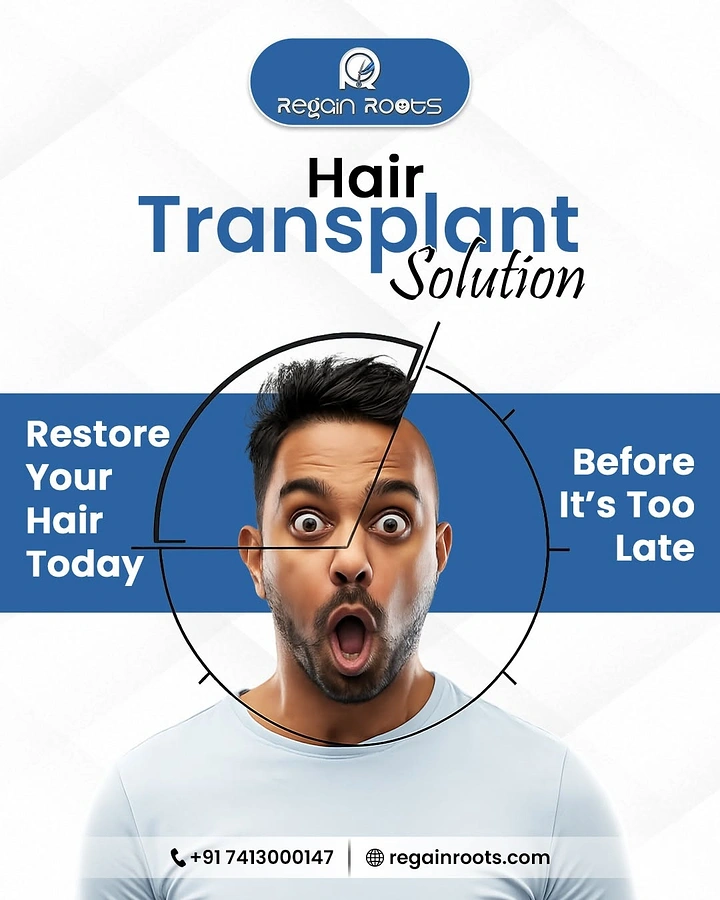 Hair Transplant & Hair Clinics creative ad: Clock hands over shocked face, time metaphor