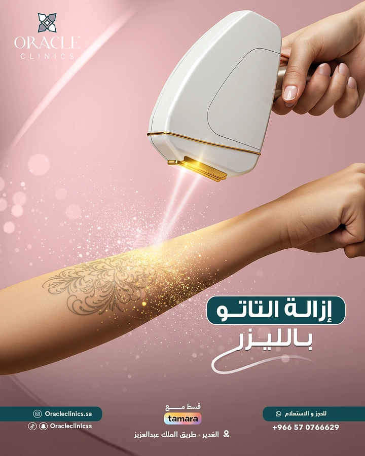 Skin & Cosmetic Clinics creative ad: Laser device dissolving tattoo into sparkles