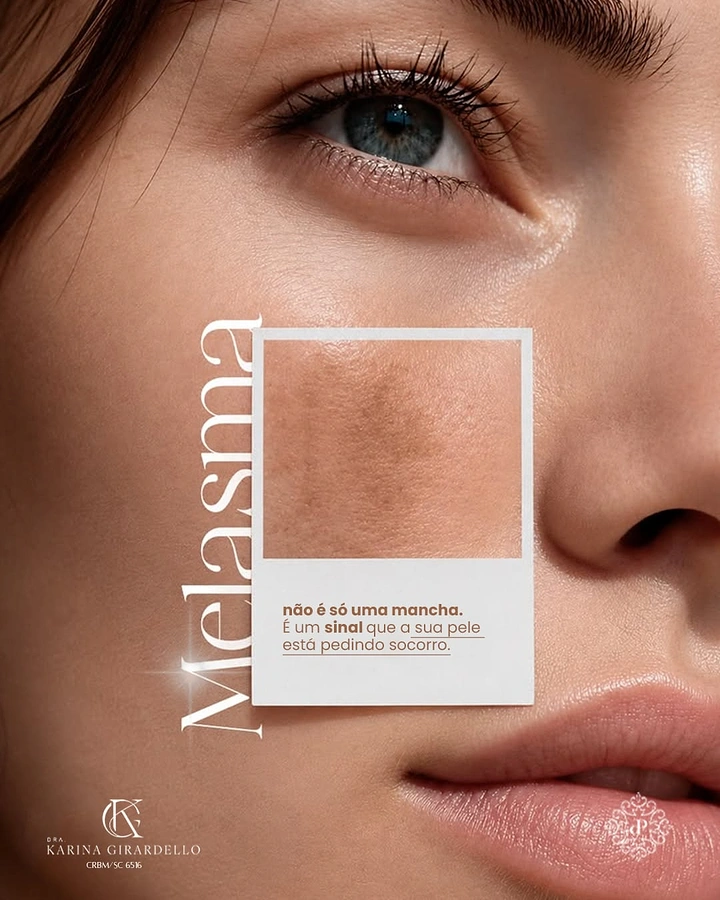 Skin & Cosmetic Clinics creative ad: Face close-up with a framed, magnified melasma patch on the cheek