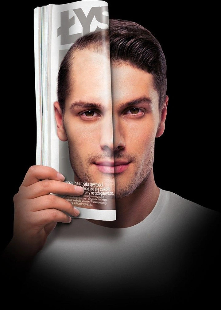 Hair Transplant & Hair Clinics creative ad: Magazine page reveals new hairline