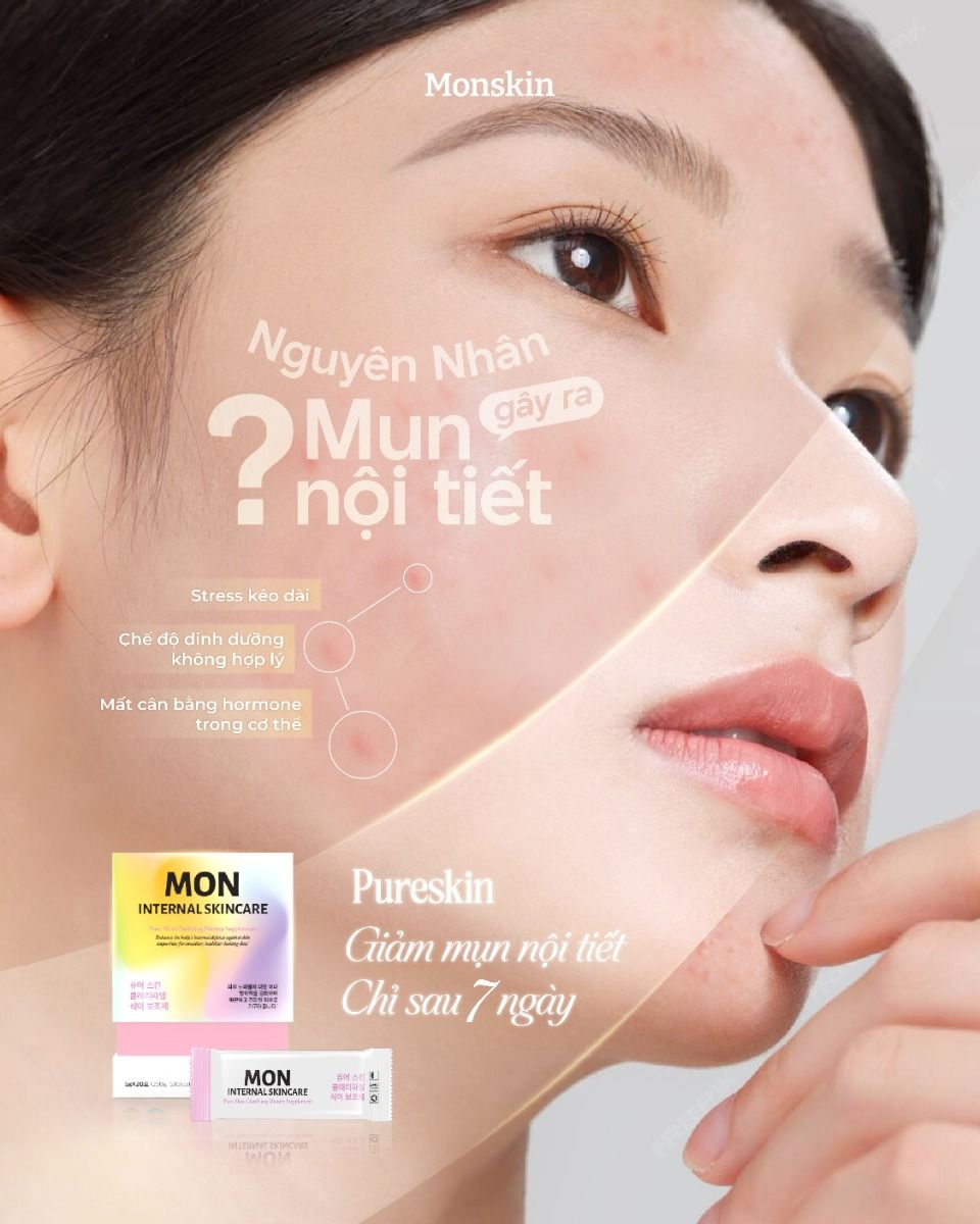 Instagram post: Glass panel reveals clear skin over acne
