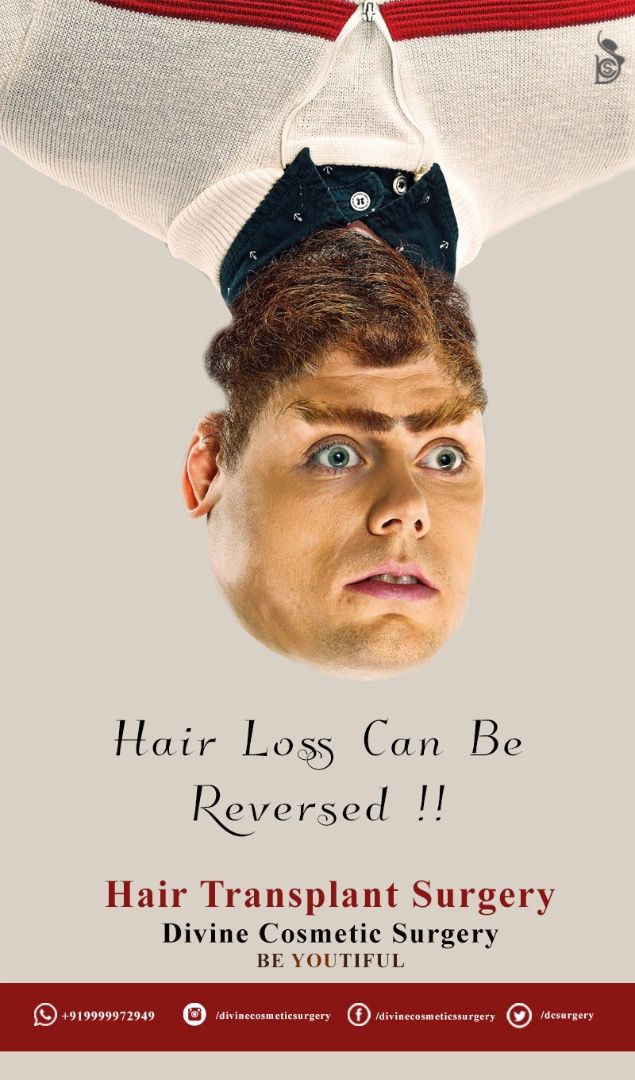 Story: Upside-down face: hair loss reversed
