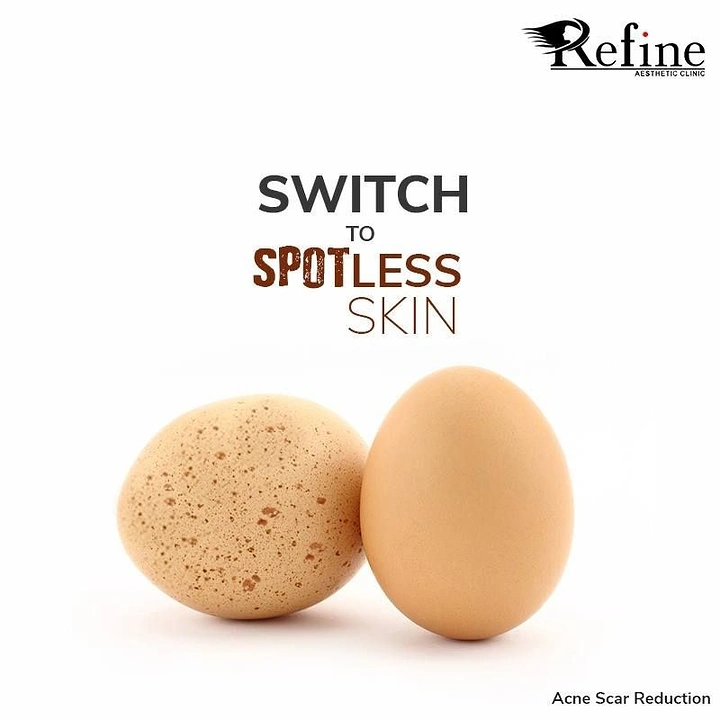 Skin & Cosmetic Clinics creative ad: Speckled vs smooth egg metaphor