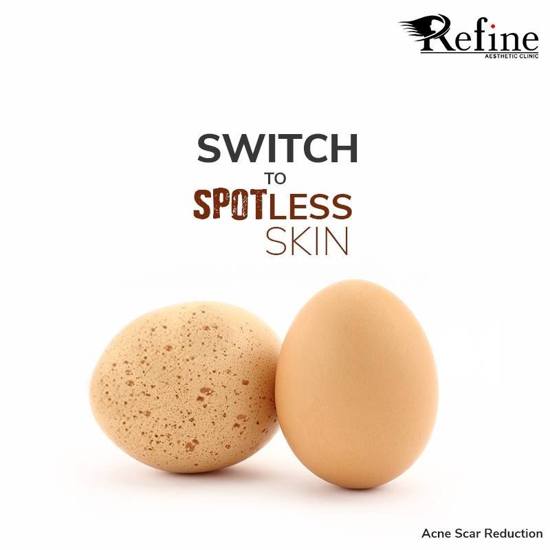 Instagram post: Speckled vs smooth egg metaphor
