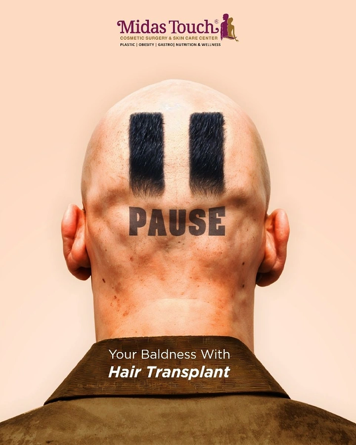 Skin & Cosmetic Clinics creative ad: Back of bald head with pause symbol made of hair
