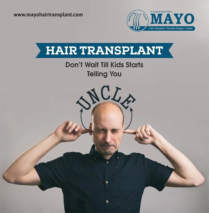 Hair Transplant & Hair Clinics creative ad: Witty 'Uncle' taunt copy idea