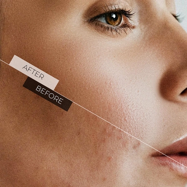 Skin & Cosmetic Clinics creative ad: Diagonal split before/after labels