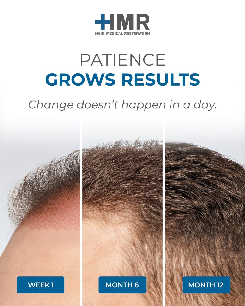 Instagram post: Split timeline growth, patience grows results