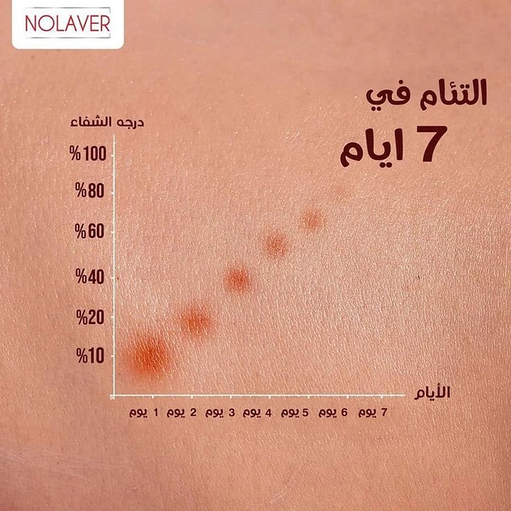 Skin & Cosmetic Clinics creative ad: Healing scars plotted as chart on skin