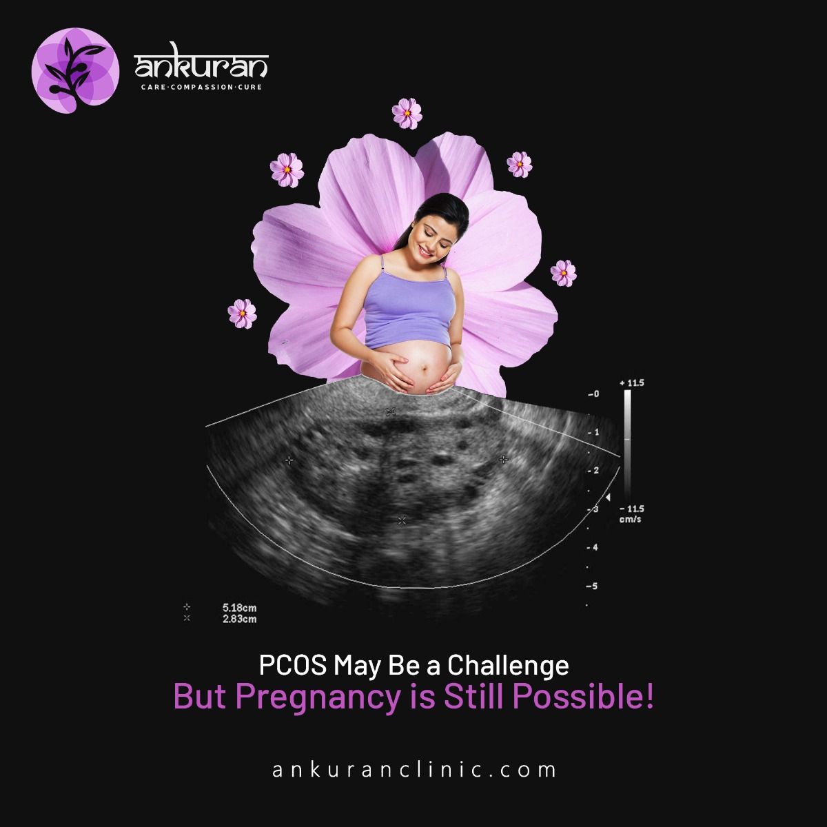 Instagram post: Ultrasound scan blooms into flower