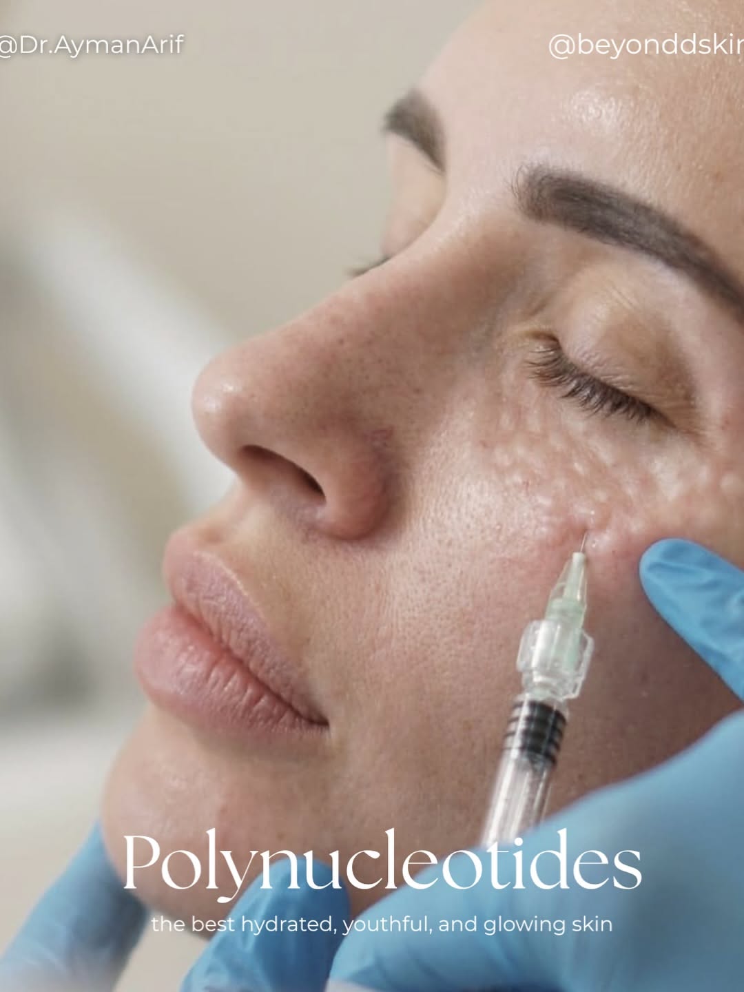 Mother's Day Carousel: Mature woman's face with a heart of moisturiser on her cheek, slide 7