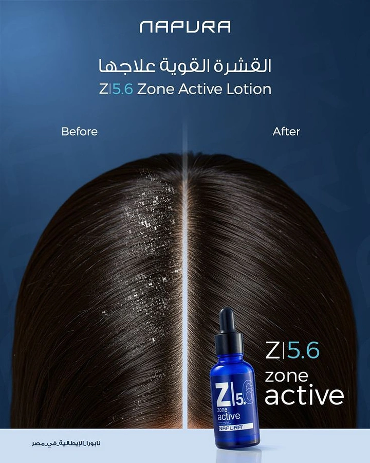 Hair Transplant & Hair Clinics creative ad: Hair parting splits before/after