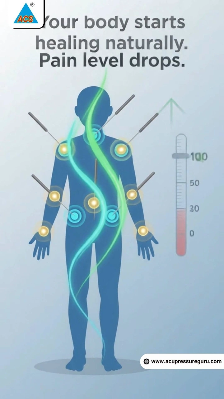 Acupuncture & Cupping Clinics creative ad: Pain-drop gauge visualizes healing claim
