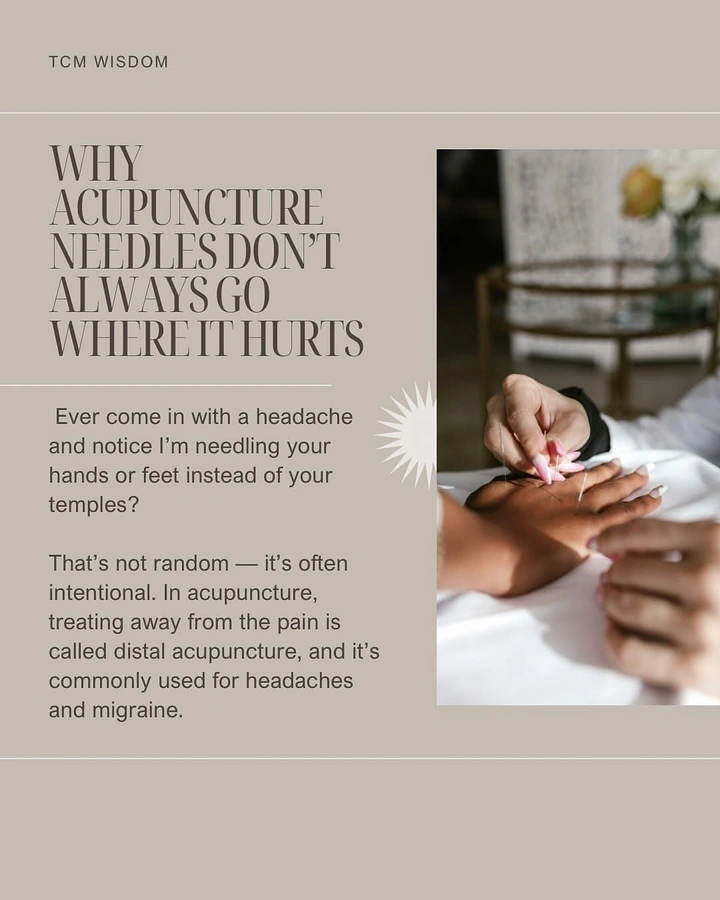 Acupuncture & Cupping Clinics creative ad: Needles go where needed, not hurting