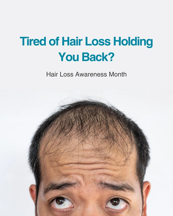 Hair Transplant & Hair Clinics creative ad: Man glancing up at own bald scalp