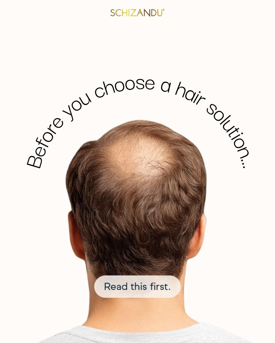 Instagram post: Curved copy arcs over bald crown, slide 1