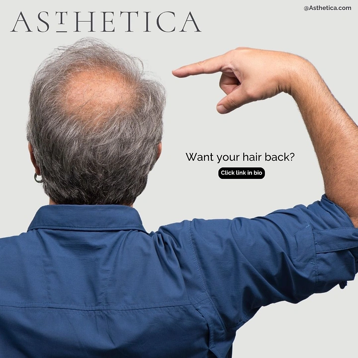 Hair Transplant & Hair Clinics creative ad: Hand pointing at bald spot, bold