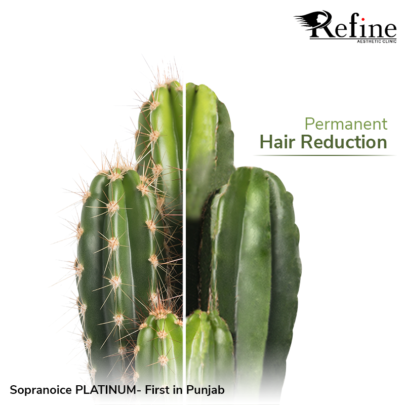Instagram post: Half-shaved cactus shows hair reduction