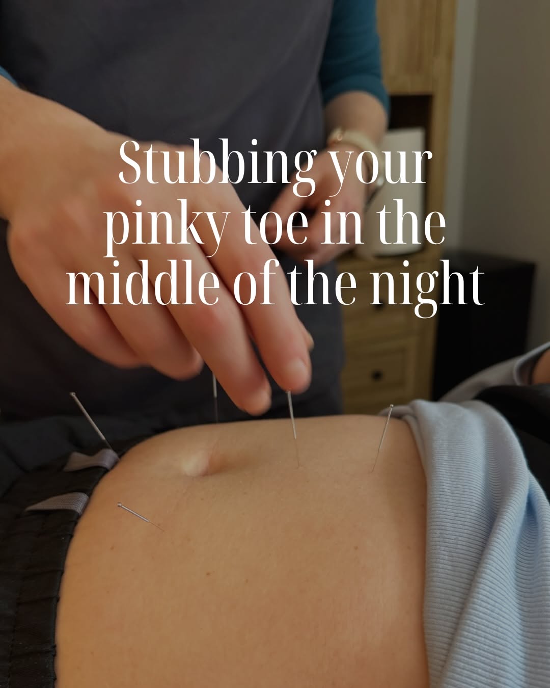 Instagram post: Witty comparison reframes acupuncture pain, slide 5