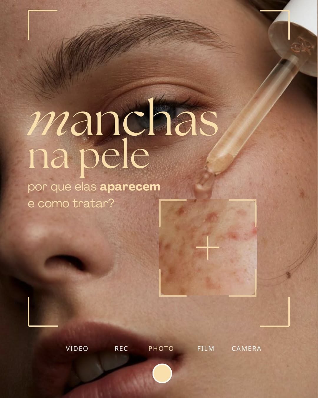 Instagram post: Close-up of woman's face with serum dropper and zoomed skin-spot inset