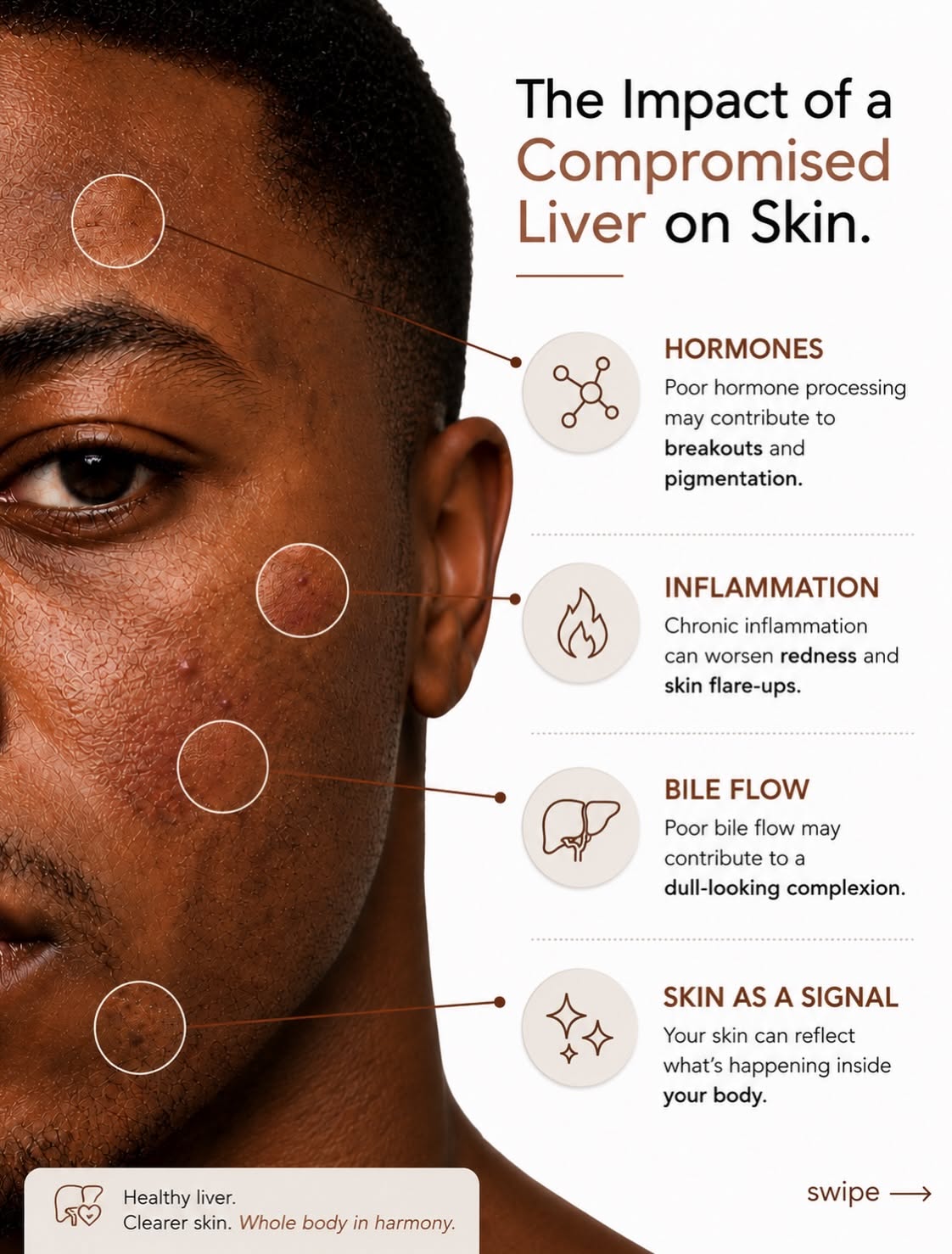 Carousel: Liver shaped as a tied gold trash bag dripping toxins onto skin, slide 2