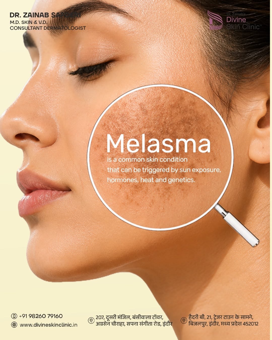 Instagram post: Case-file folder for melasma awareness, slide 2