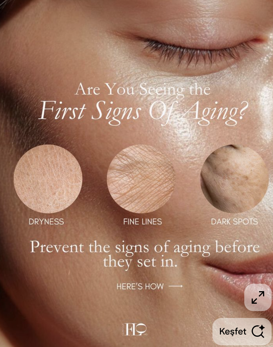 Instagram post: Magnified skin circles show aging signs