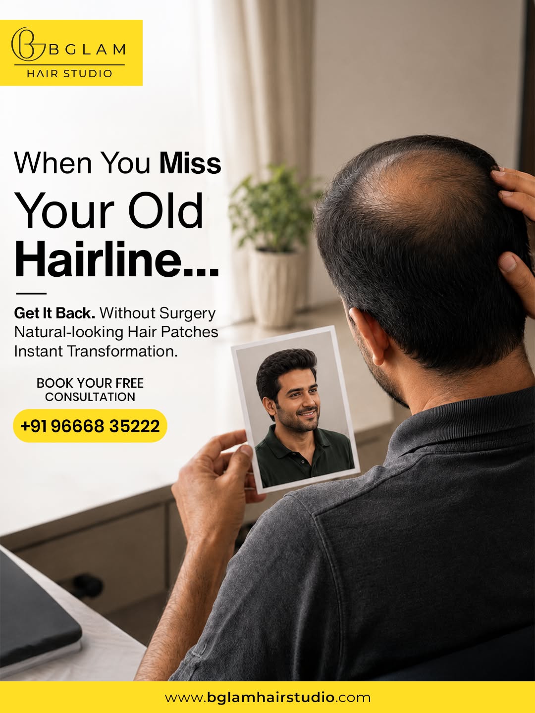 Instagram post: Man holding photo of old hairline