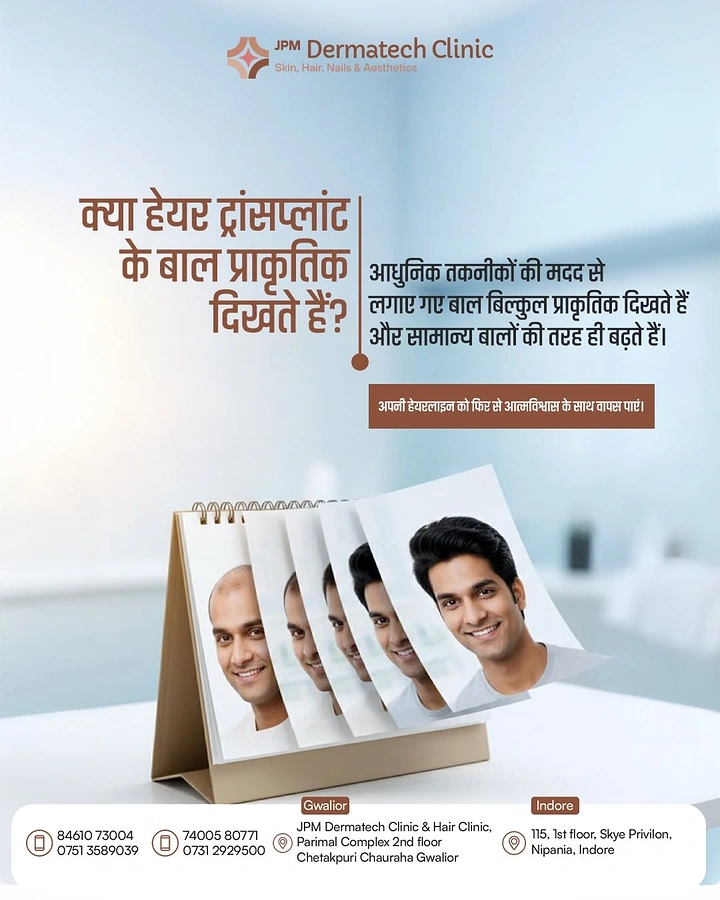 Hair Transplant & Hair Clinics creative ad: Flip calendar shows hair growth progression