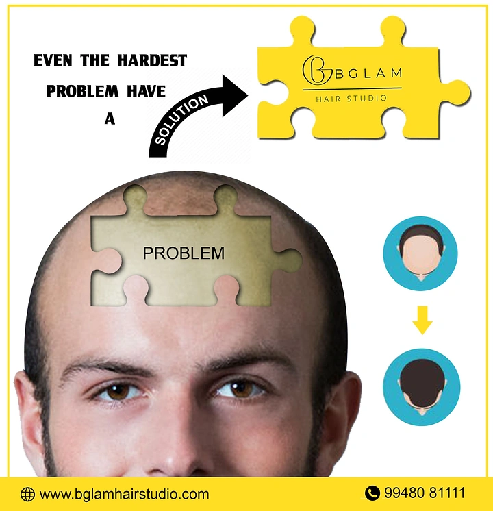 Hair Transplant & Hair Clinics creative ad: Puzzle-piece problem-solution scalp metaphor