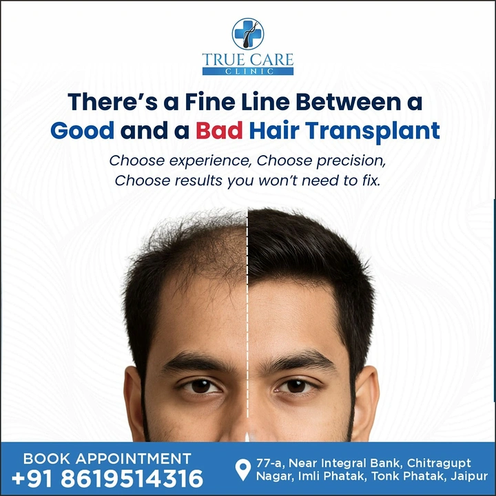 Hair Transplant & Hair Clinics creative ad: Fine line split face, copy pun